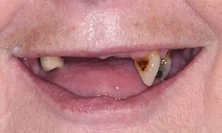 House of Dental - Before