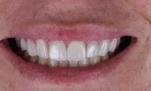 House of Dental - After